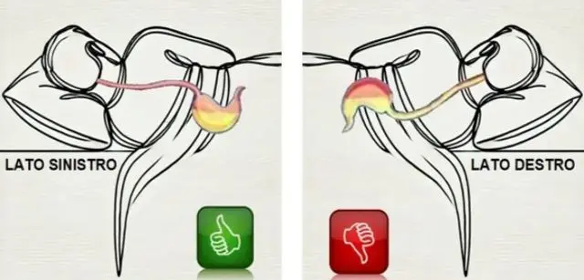 Dormire sul lato giusto: Lezione di salute e le analogie con il mondo delle imprese